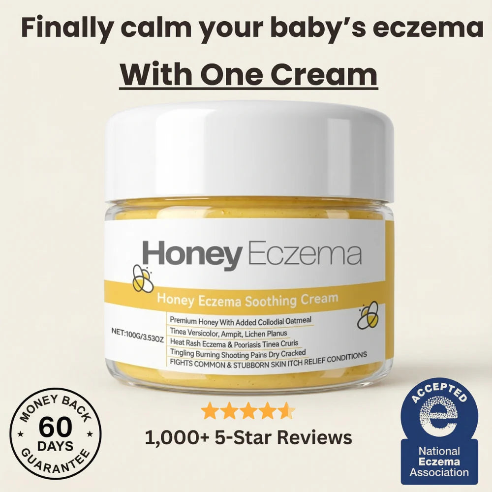 Honey Eczema Soothing Cream 100ML - Soft Relief for Little Ones with Sensitive Skin