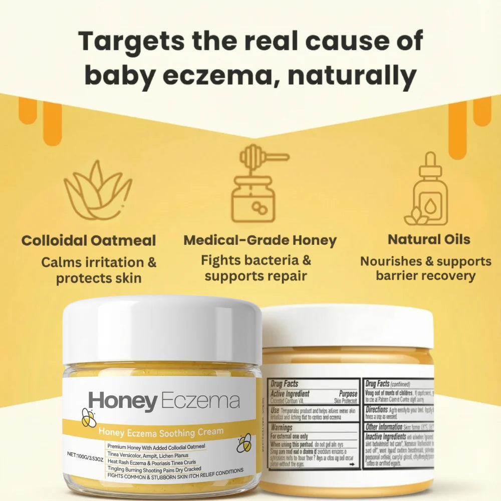Honey Eczema Soothing Cream 100ML - Soft Relief for Little Ones with Sensitive Skin