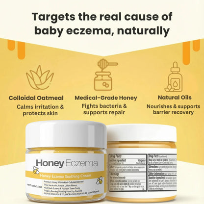 Honey Eczema Soothing Cream 100ML - Soft Relief for Little Ones with Sensitive Skin