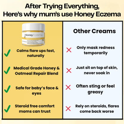 Honey Eczema Soothing Cream 100ML - Soft Relief for Little Ones with Sensitive Skin