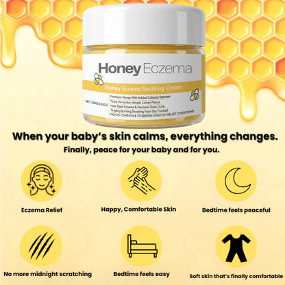 Honey Eczema Soothing Cream 100ML - Soft Relief for Little Ones with Sensitive Skin
