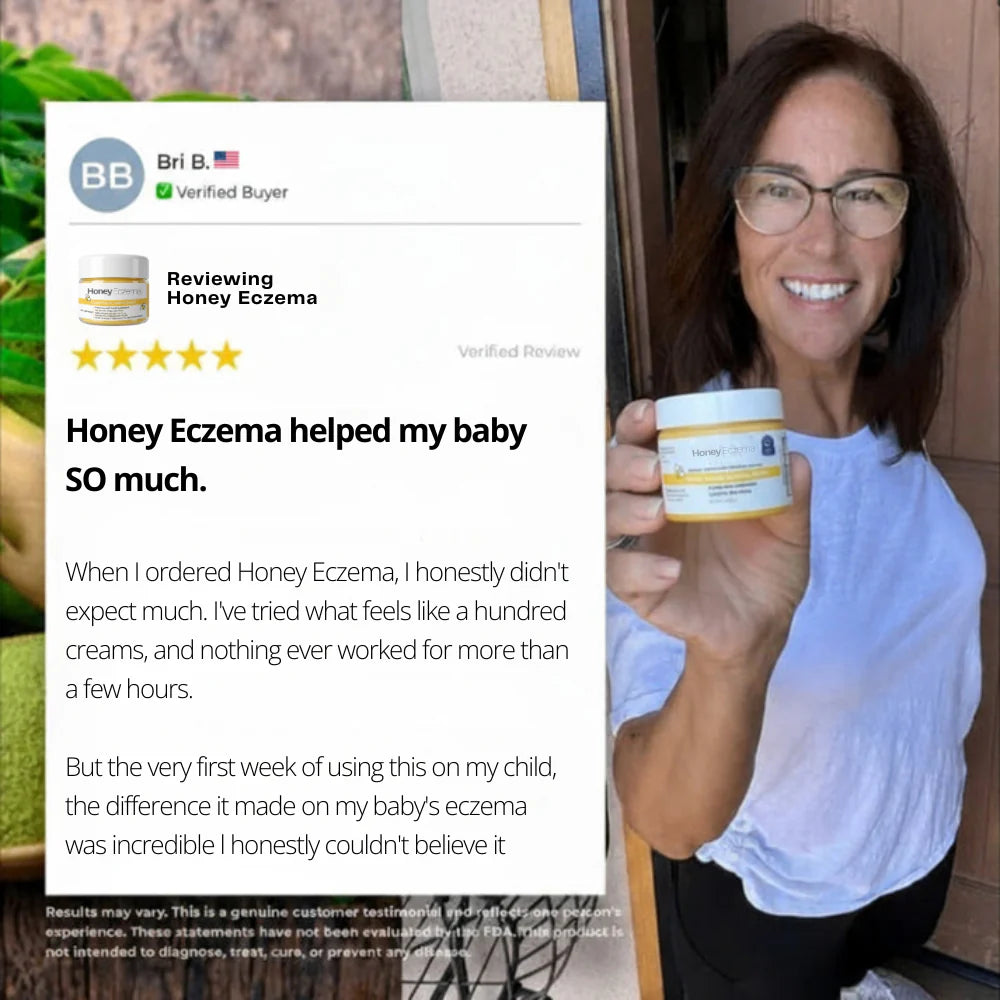 Honey Eczema Soothing Cream 100ML - Soft Relief for Little Ones with Sensitive Skin